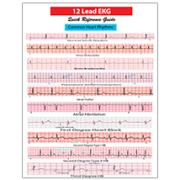EKG-card-revised-1 EKG-card-revised-1