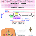 EKG-revised-card-2-150x150 EKG-revised-card-2-150x150