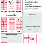 EKG-revised-card-4-150x150 EKG-revised-card-4-150x150