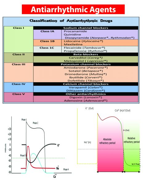 Antiarrhythmic Ed II Side 1 Antiarrhythmic Ed II Side 1