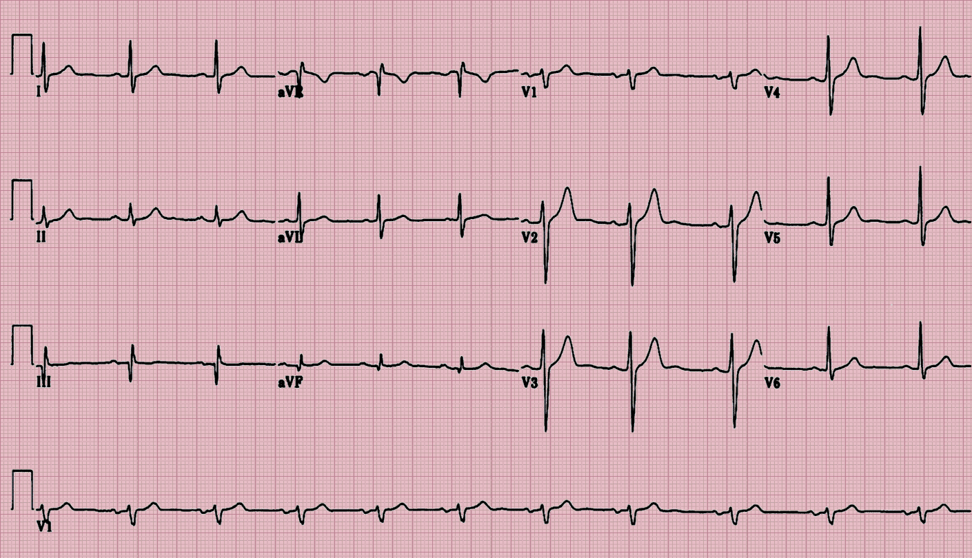 ekg certification online